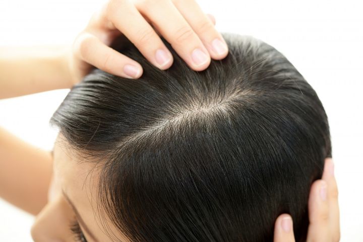 薄毛が気になる年齢は？