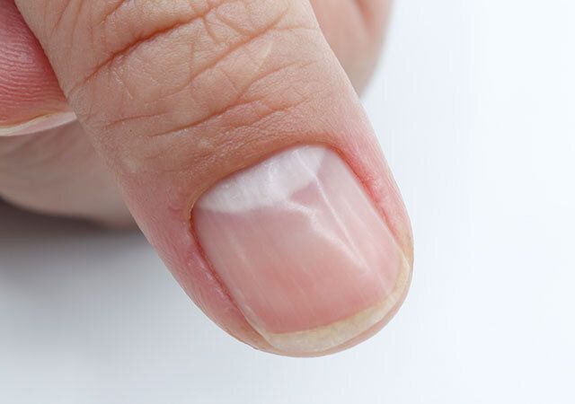 爪をダイソーのネイルケアブロックで磨いた様子