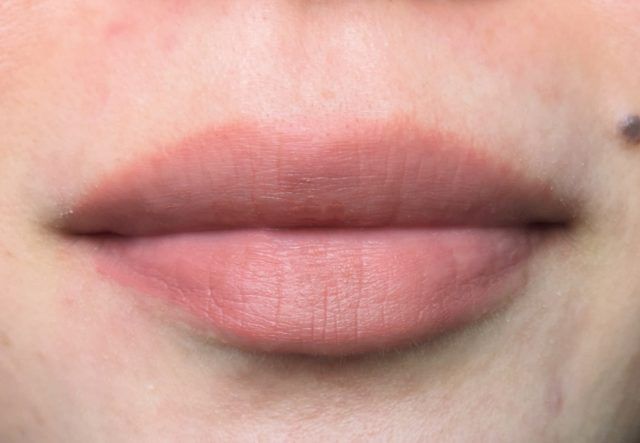 キヌルージュ マットの写真