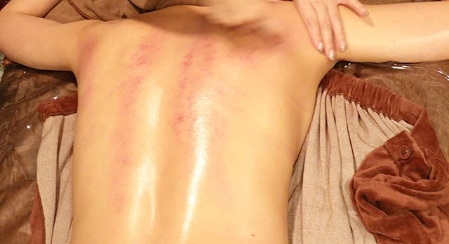 カッサ施術画像