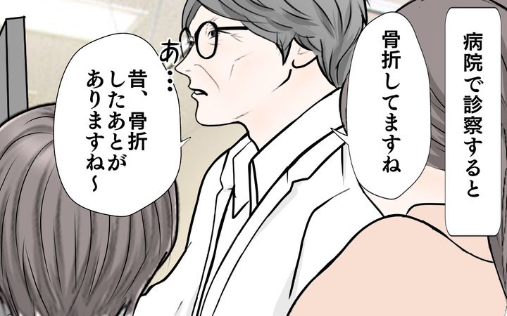 病院で診察すると、骨折しているそうで…。しかも、昔、次女は骨折したことがあると…！