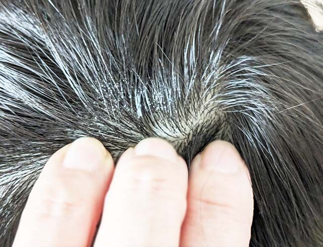 【無印良品】「水のいらないシャンプー」を頭皮に揉み込んでいる様子