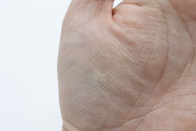 GENE TOKYO リキッドコンシーラーは肌のお悩みをきれいにカバーできる