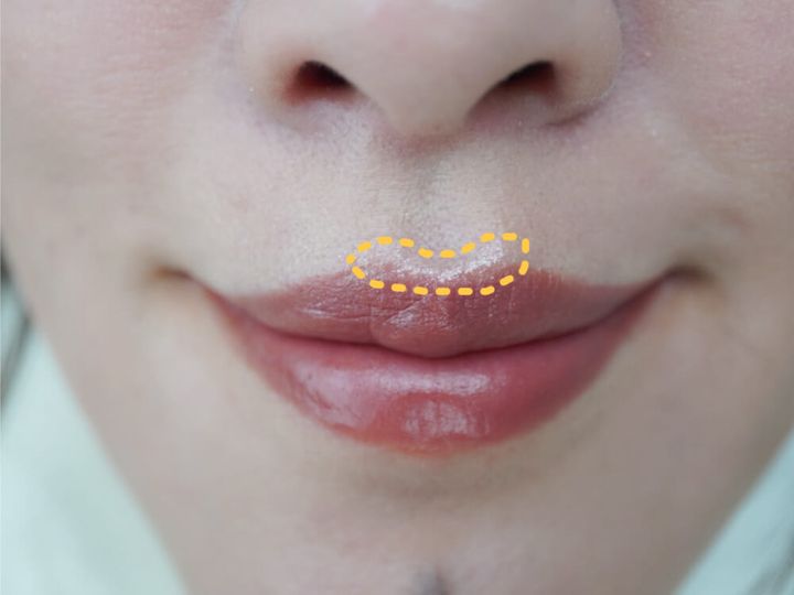 上唇にもちょこっと