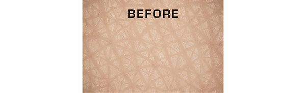 肌の見た目はどう変化する？／BEFORE