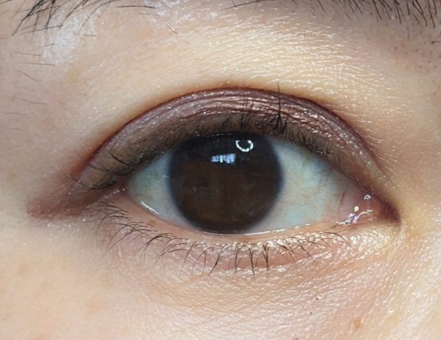 リンメルの写真