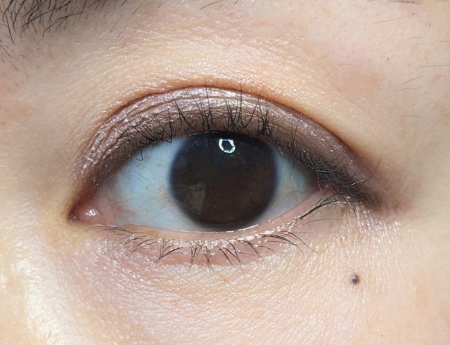 リンメルの写真