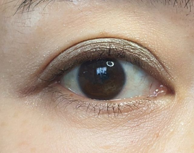 リンメルの写真