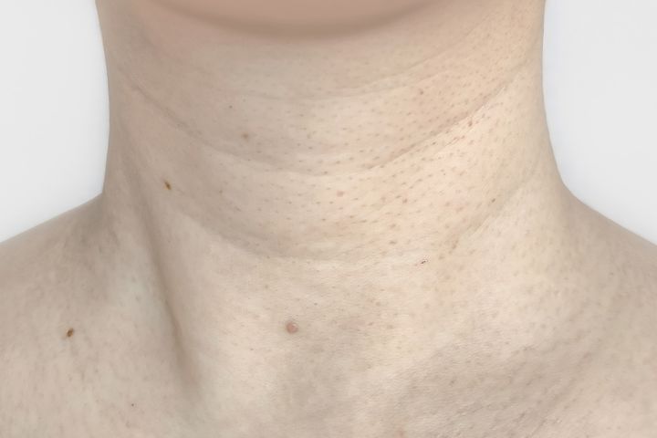 首のシワのイメージ