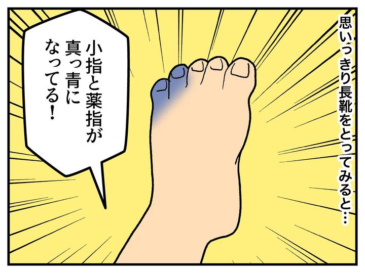 画像3: 足の小指をぶつけてしまった