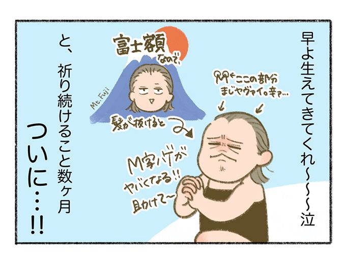 産後の母の悩み、抜け毛。悲しい変化に息子の反応は？【まいにちてんてこまい・9】の画像5