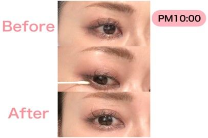 パンダ目修正イメージ画像