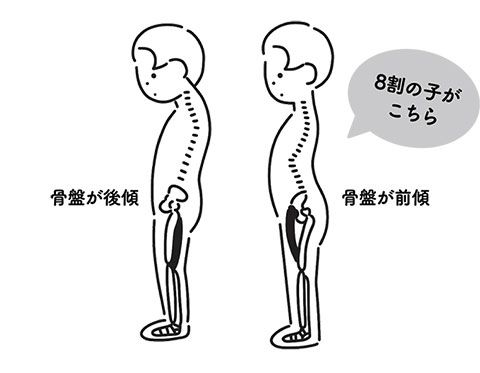 子どもの「猫背」がクセに？ お子さん、こんなふうになっていませんか？【最新号からちょっと見せ】の画像7