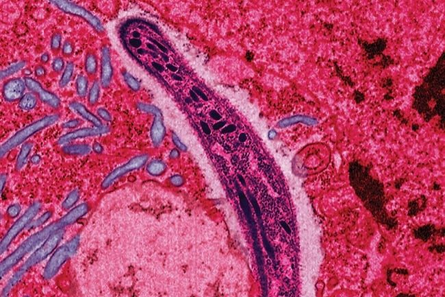 マラリア: 気候変動は媒介生物媒介疾患の蔓延にどのような影響を与えるでしょうか?