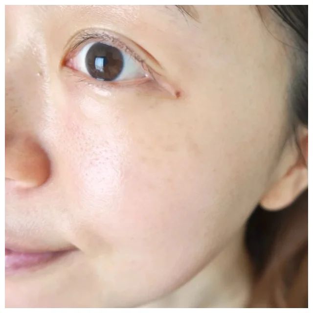 「メディプローラー CO2ジェルマスク プレミアム」の口コミ＆レビュー_2