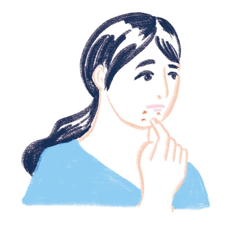 ぽつぽつニキビ肌