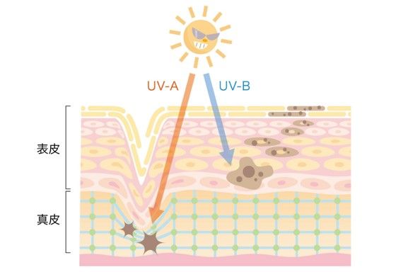 紫外線イメージ画像