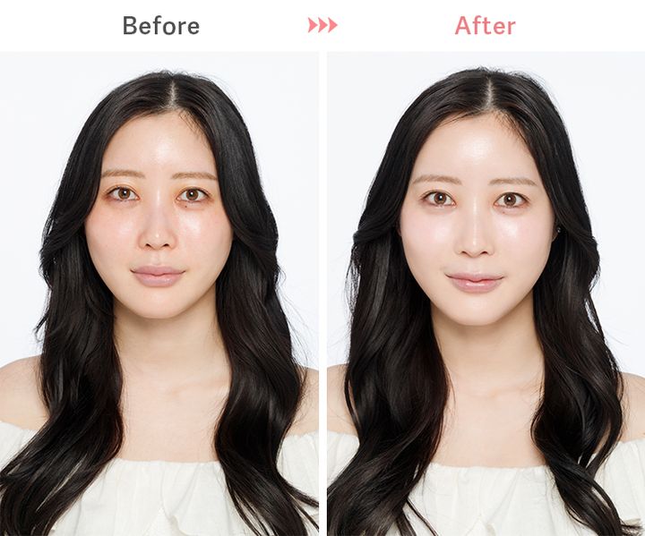 ふくれなさんビフォーアフター