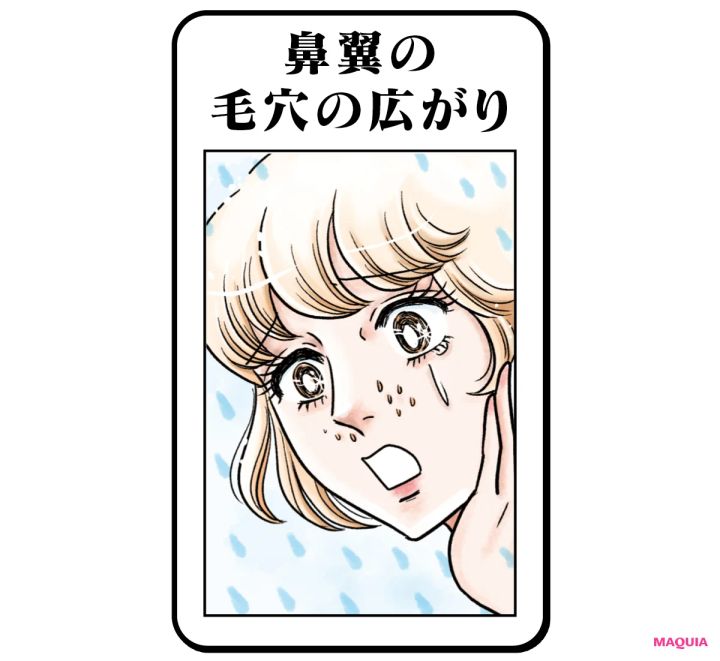 鼻翼の毛穴の広がり