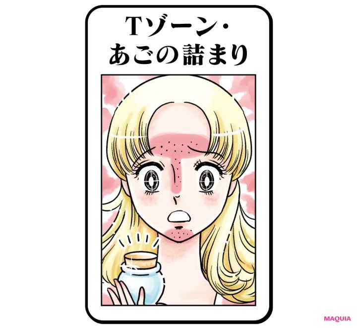 Tゾーン・あごの詰まり