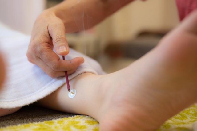 お灸の画像