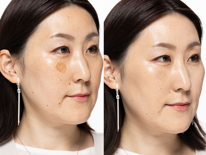 エスポア プロテーラー ビーグロウクッション ニュークラス スウォッチ