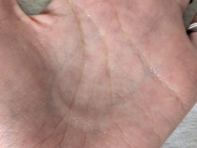 ニードルコスメの写真