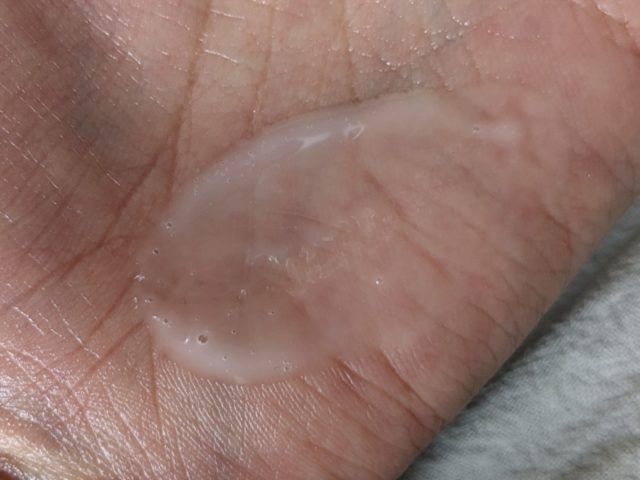 ニードルコスメの写真