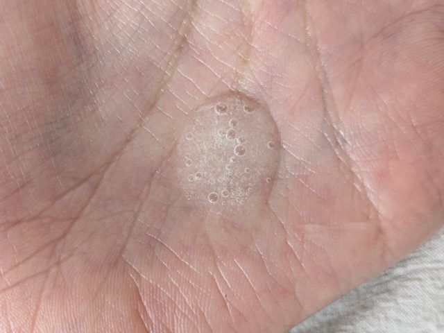 ニードルコスメの写真