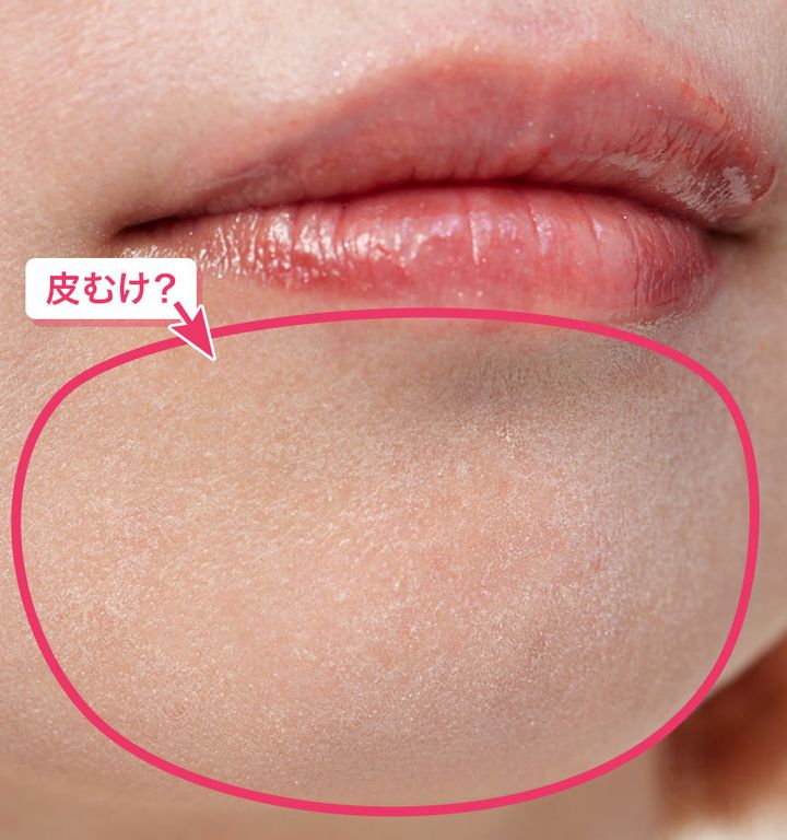 ファンデを塗った瞬間、謎の皮むけが出現。その原因は？