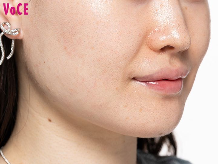 厚肌の特徴・見分け方は？