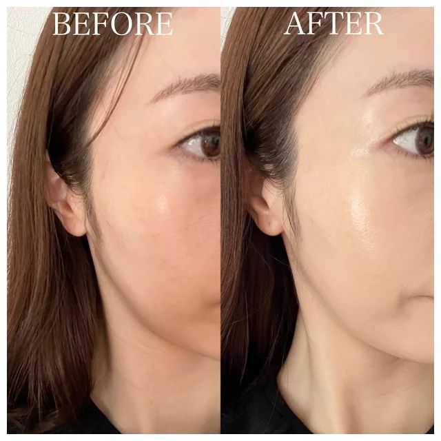 SHISEIDO エッセンス スキングロウ ファンデーションの口コミ＆レビュー_「綺麗なツヤ感と自然なカバー力で、素肌感重視の方におすすめ」_2