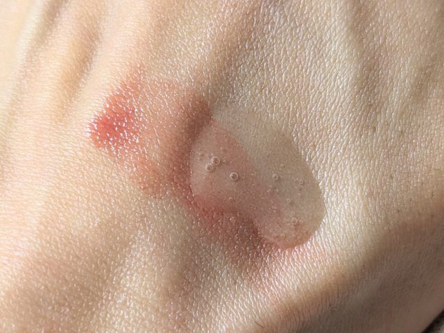 アテニアの写真