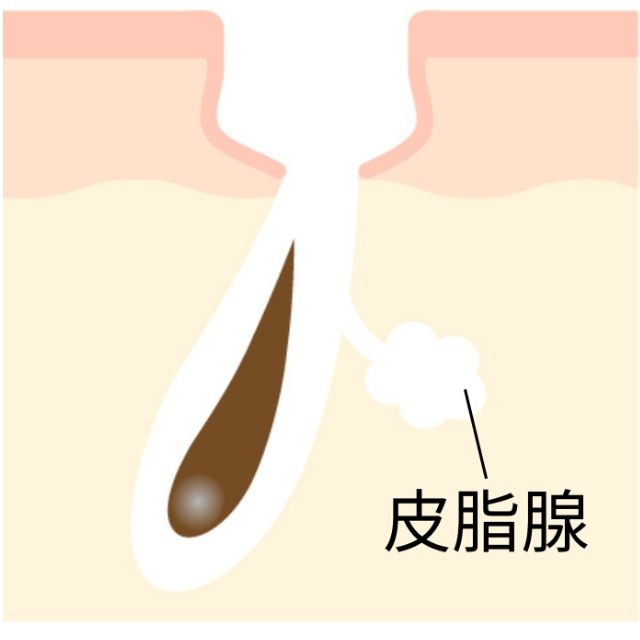 毛穴のつまりや黒ずみ