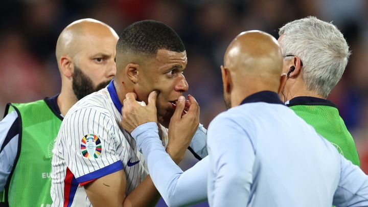 EUROで鼻負傷のエムバペ、「マスクのアイデアある？（冷や汗）」とSNSに投稿