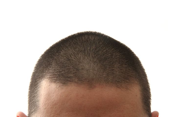 丸刈り強要は違法？