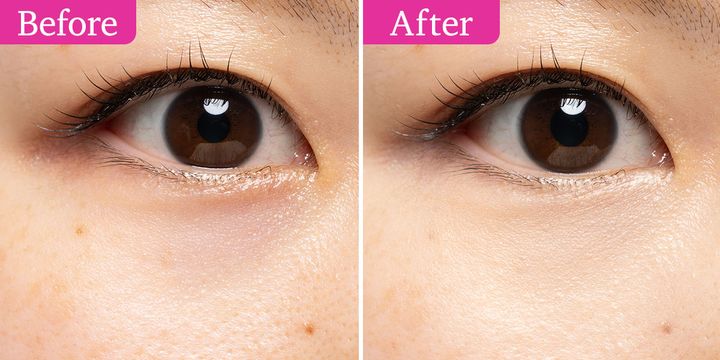 シュウ ウエムラ アンリミテッド CCC クワッド コンシーラー