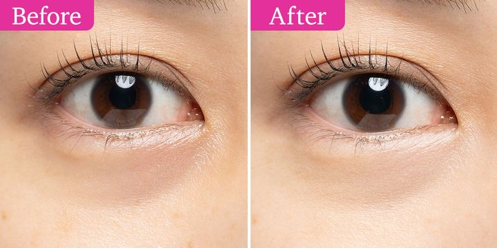 アルブラン クラリティブラン カモフラチップ