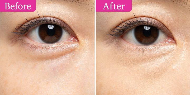 ファシオ ウルトラカバー コンシーラー WP