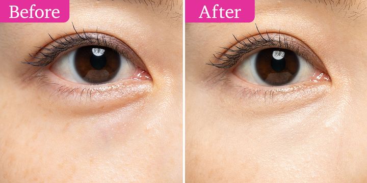 ディオール ディオールスキン フォーエヴァー スキン コレクト コンシーラー 00.5N