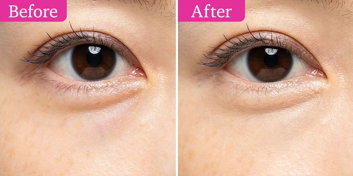 キス スキニー リキッドコンシーラー