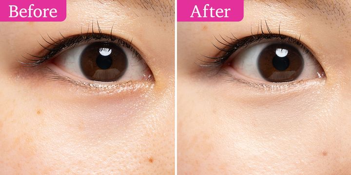 イヴ・サンローラン オールアワーズ コンシーラー