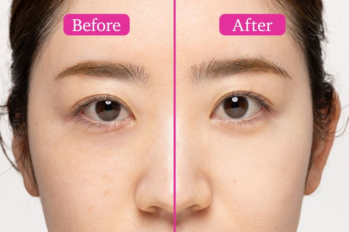 目の下のたるみをカバーしてリフトアップも叶えるメイク術