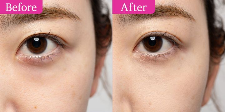 目の下のたるみをカバーしてリフトアップも叶えるメイク術