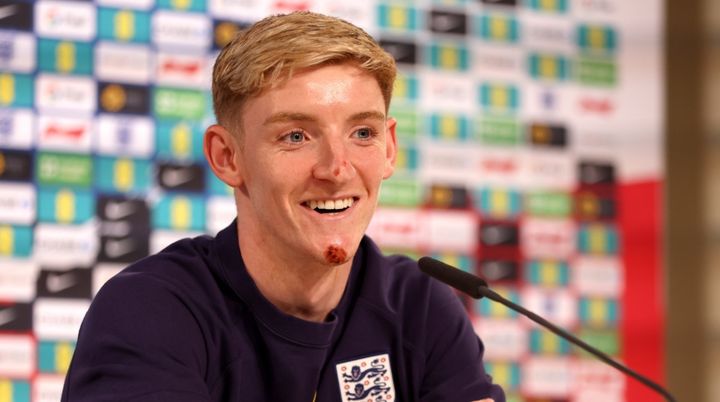 「俺は悪夢的な選手」 EUROイングランド代表FWゴードン、敵から嫌われていると豪語！