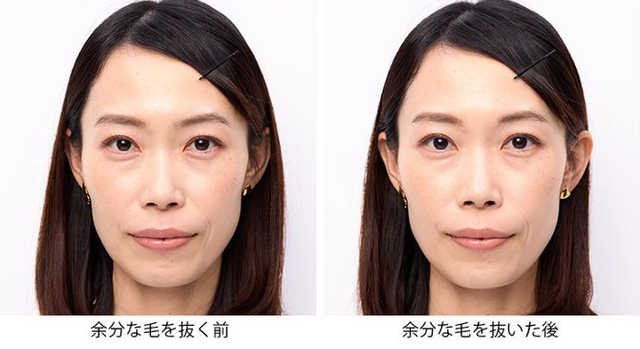 余分な毛を抜く前、余分な毛を抜いた後