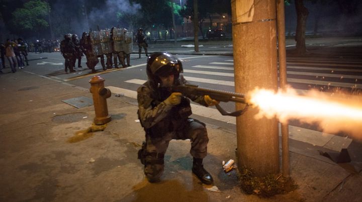 GKが警官からゴム弾で撃たれて足が血だらけ…3度熱傷で「恐ろしく信じられない犯罪行為」