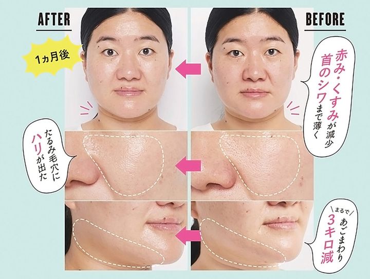 ガンバレルーヤよしこさんの肌が革命級に変わった！ たった1ヵ月で毛穴感が減少＆たるみもとれて顔がスッキリ！