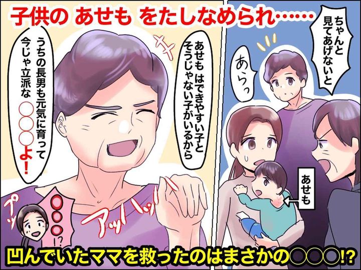 画像: 【子どものあせも】に「お母さんったら駄目ねぇ！！」説教されてヘコむ私 → 『救世主の言葉』に感謝！