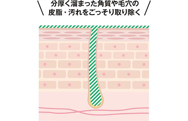 分厚く溜まった角質や毛穴の皮脂・汚れをごっそり取り除く